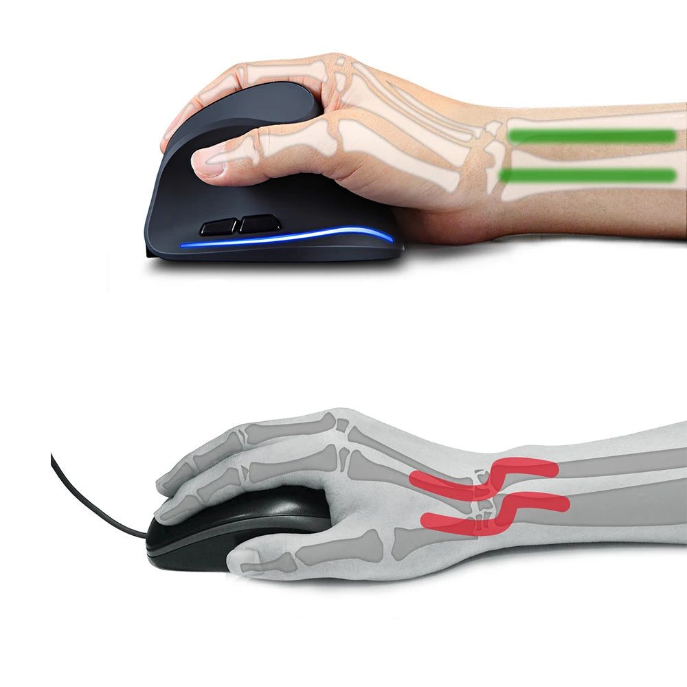 Souris ergonomie tms